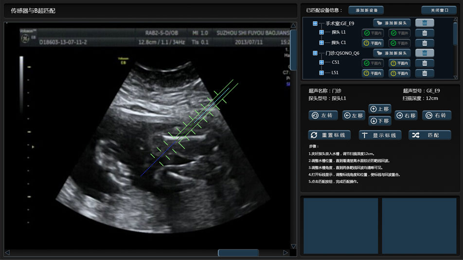 武漢睿影醫(yī)療科技超聲系統(tǒng)軟件界面設(shè)計(jì)